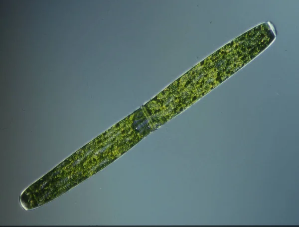 Algas Verdes Alta Ampliação Sob Microscópio — Fotografia de Stock