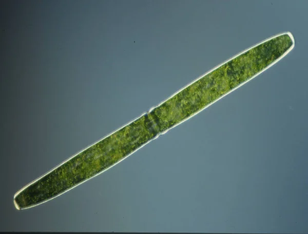 显微镜下高倍放大绿藻 — 图库照片