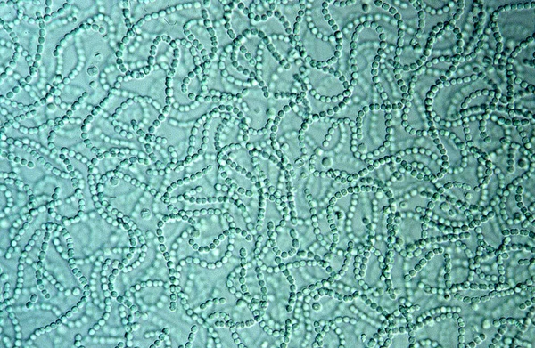 Ланцюги Синьо Зелених Водоростей Під Мікроскопом — стокове фото