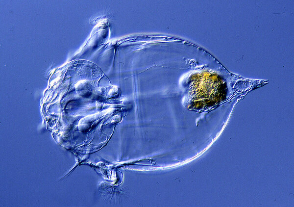 Asplanchna rotifer in drops of water under a microscope 200x