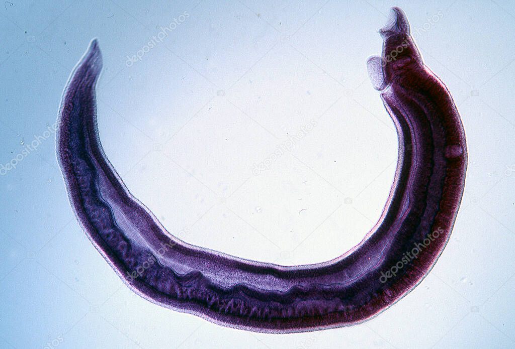 Schistosomiasis leeches as a parasite under the microscope 100x