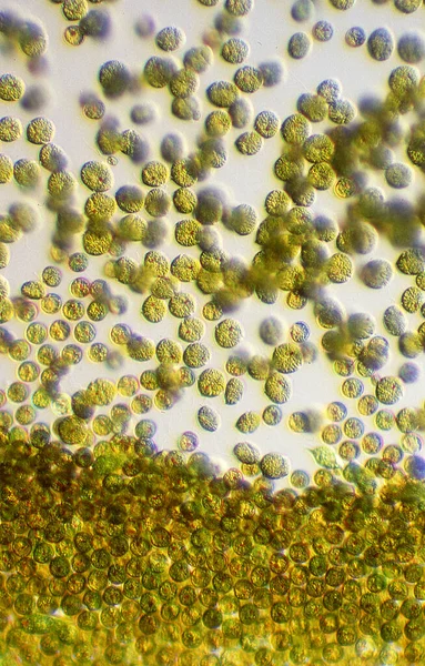 Algas Douradas Tóxicas Flor Algas Microscópio — Fotografia de Stock