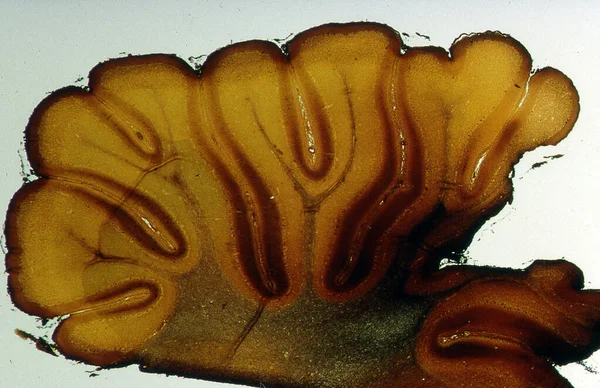 Cerebellum Μετά Την Επένδυσή Του Στο Διάμηκες Τμήμα Στο Μικροσκόπιο — Φωτογραφία Αρχείου