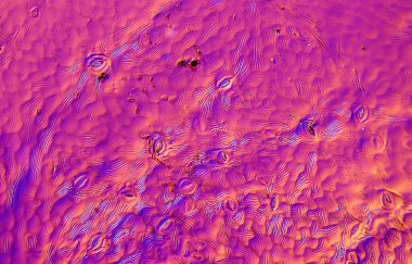 Çarşafın altında stomata Rheinberg ışıklandırmasında vernik etkisi oluşturur.