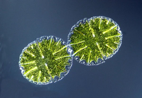顕微鏡下の観賞用藻類ミクロステリア — ストック写真