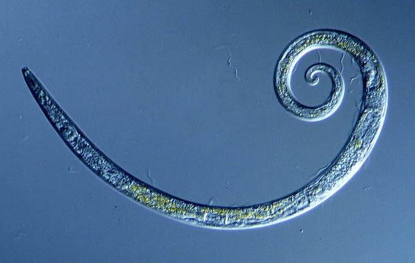 Enrolado Nematoide Uma Gota Água 100X — Fotografia de Stock