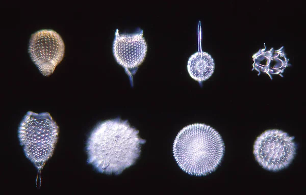 Radiolaria Dans Champ Sombre Sous Microscope 100X — Photo