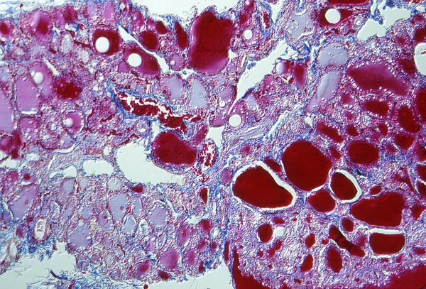 Histologiczne Cienkie Odcinki Przez Tarczycę Koziołkiem — Zdjęcie stockowe