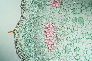 Enine kesitte ısırgan kökü 100x