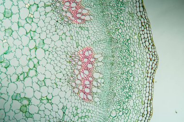 Enine kesitte ısırgan kökü 100x