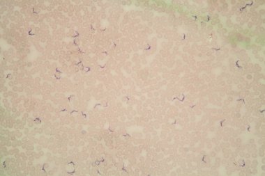 Chagas hastalığının tripanozomları kanda 400x parazit oluşturur.