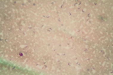 Chagas hastalığının tripanozomları kanda 400x parazit oluşturur.