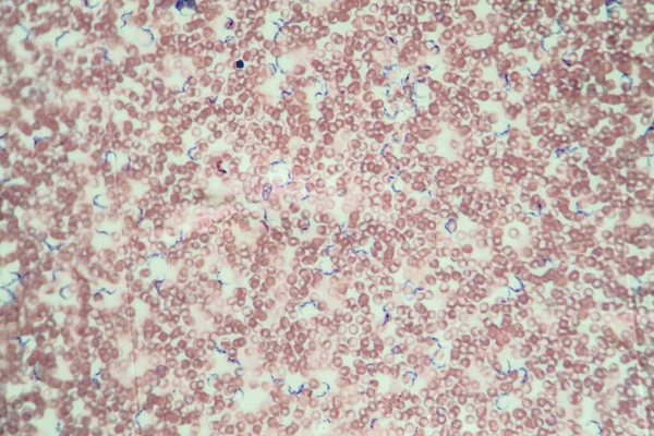 Trypanosomes Chagas Betegség Paraziták Vérben 400X — Stock Fotó