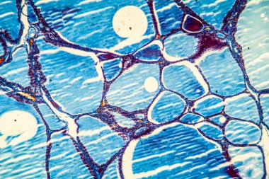 Koloidli tiroit dokusu. 100 x.