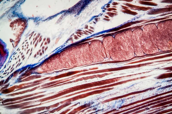 Miescher tubes in infected muscle tissue 100x