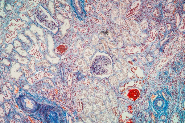 顕微鏡下でのアトロフィー腎臓組織100倍 — ストック写真