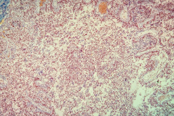 顕微鏡下での肝組織のコクチディオシス100倍 — ストック写真