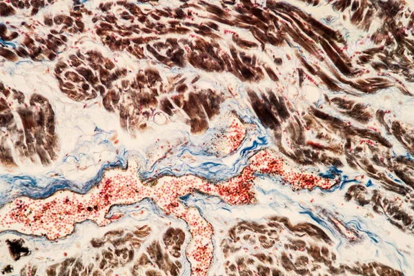 Tessuto Cardiaco Grasso Microscopio 200X — Foto Stock