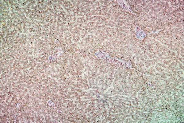 100X显微镜下的嗜血杆菌病组织 — 图库照片
