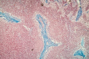 Mikroskop altında lenf nodu dokusu 100x