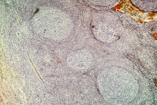 Tonsil Palatal Melintang 100X Bawah Mikroskop — Stok Foto