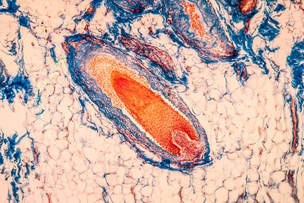 Scalp Ιστό Τριχών Κάτω Από Μικροσκόπιο 100X — Φωτογραφία Αρχείου