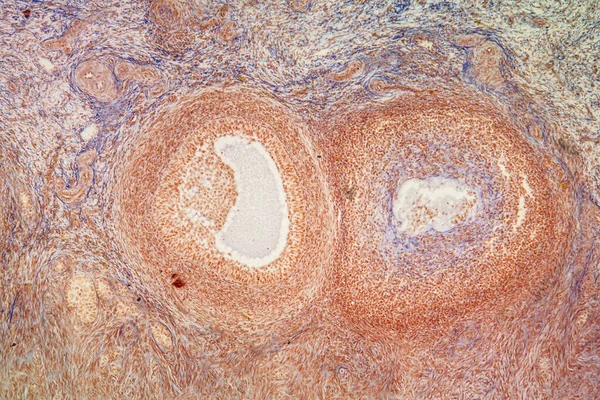 Eierstockgewebe Unter Dem Mikroskop 100X — Stockfoto