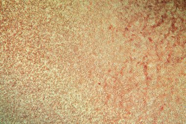 Kesit 100x kesitinde dentin olan diş kaplaması