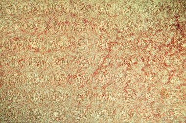 Kesit 100x kesitinde dentin olan diş kaplaması