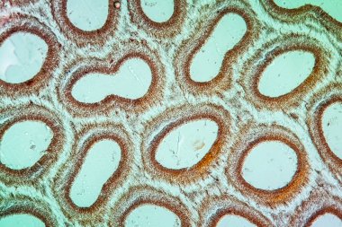 Mikroskop altında meyve veren vücut 100 kat genişliğinde.