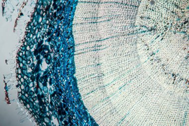 Enine kesitte geniş dal 100x