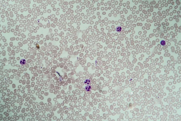 적혈구와 백혈구 400X — 스톡 사진