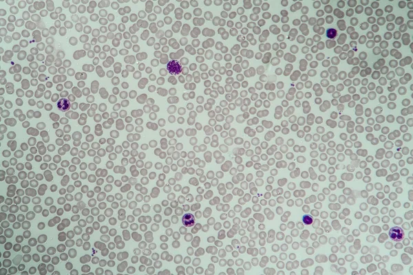 적혈구와 백혈구 400X — 스톡 사진