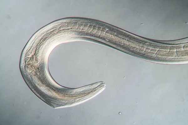 Photograph of a nematode (under microscope; ×100) indicating the three