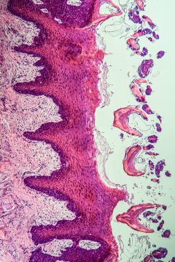 Çapraz maymun dili, papillae 100x