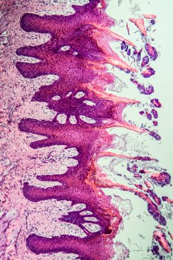 Çapraz maymun dili, papillae 100x