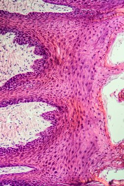 Çapraz maymun dili, papillae 200x