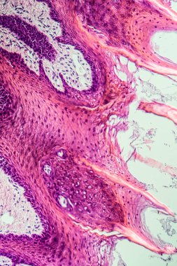 Çapraz maymun dili, papillae 200x