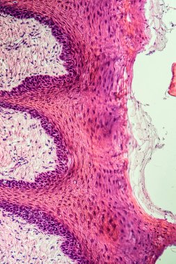 Çapraz maymun dili, papillae 200x