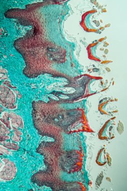 Çapraz maymun dili, papillae 100x