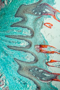 Çapraz maymun dili, papillae 100x