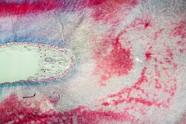 Hastalıklı kesici dişleri 100x boyunca taşır