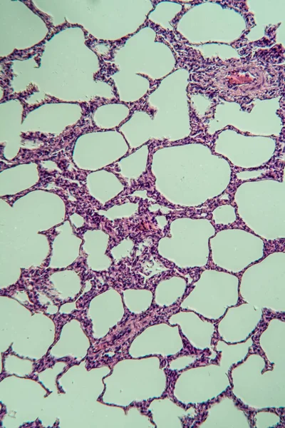Płuca Pod Mikroskopem 100X — Zdjęcie stockowe