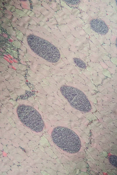 Sarcocystis spore animals in muscle, 100x