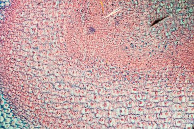 Kök ucu 100 x boyunca uzanan Gladiolus