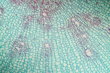 Kökü 100 x olan yabanturpu