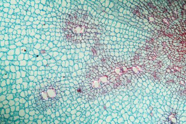 Kökü 100 x olan yabanturpu