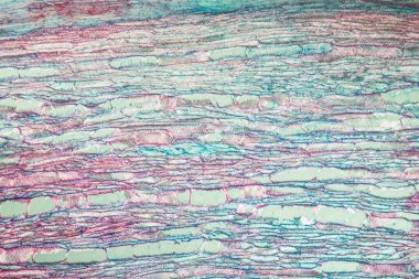 Süt tüpleriyle birlikte 100 kat karahindiba tapotu kökü.