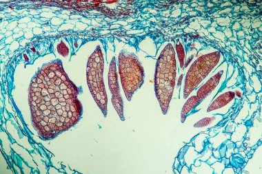Nestwurz orkide kökü çapraz 100x