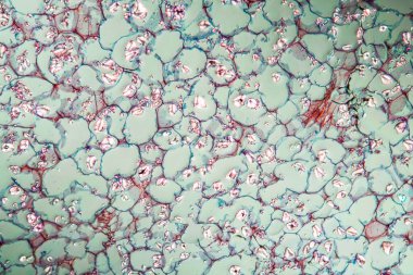 Nişasta tanecikli kereste. 100 kat fazla.